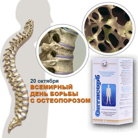 20 октября — Всемирный день борьбы с остеопорозом