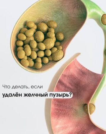 Если желчный удалён